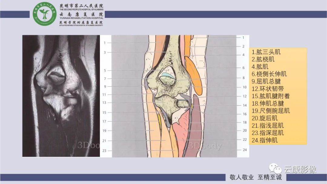 影像PPT - 【PPT】肘关节影像学解剖-19