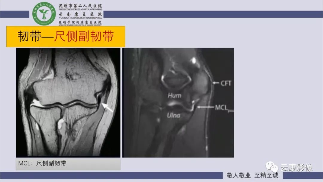 影像PPT - 【PPT】肘关节影像学解剖-22