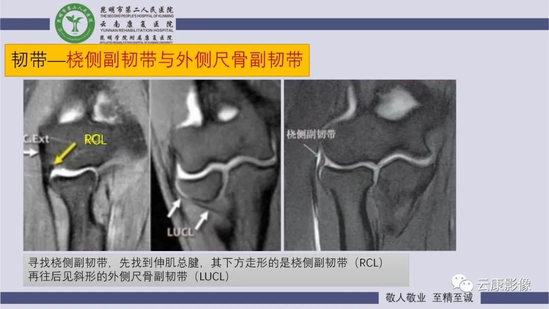 影像PPT - 【PPT】肘关节影像学解剖-24