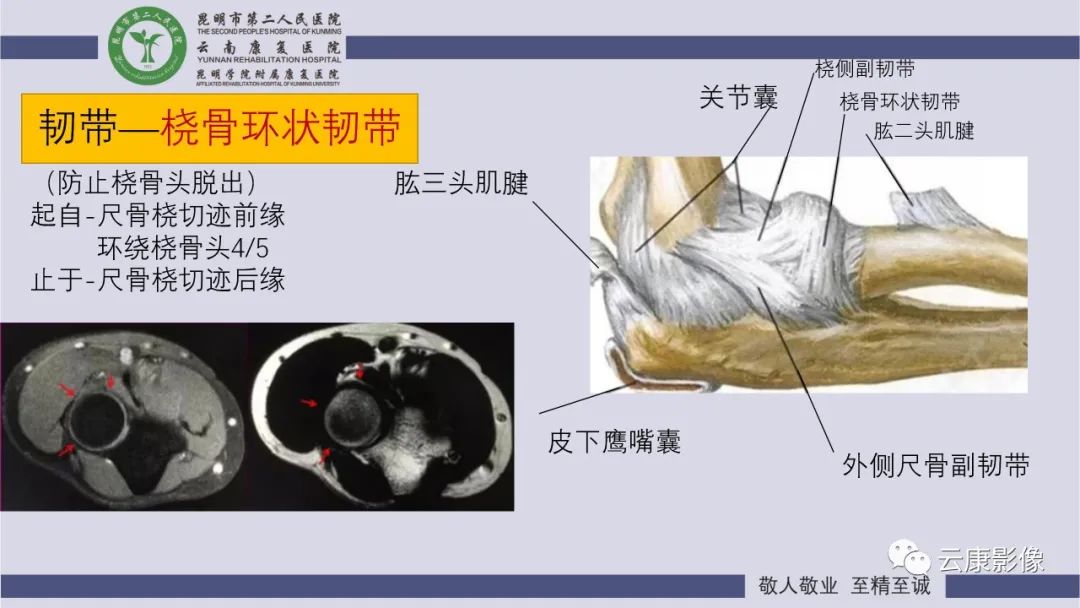 影像PPT - 【PPT】肘关节影像学解剖-25