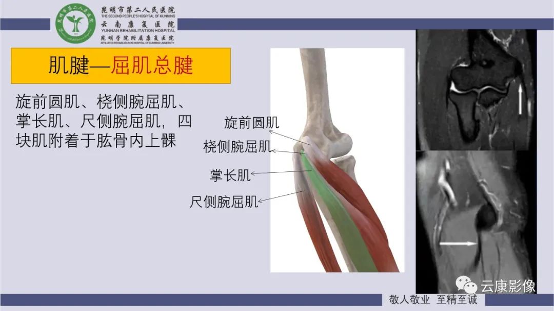 影像PPT - 【PPT】肘关节影像学解剖-26