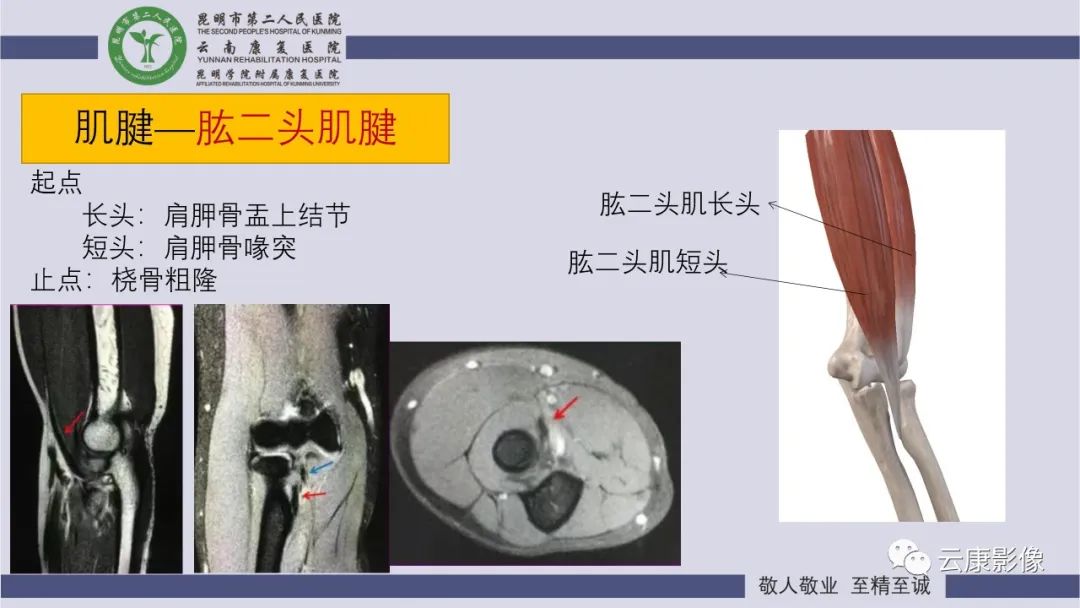 影像PPT - 【PPT】肘关节影像学解剖-27