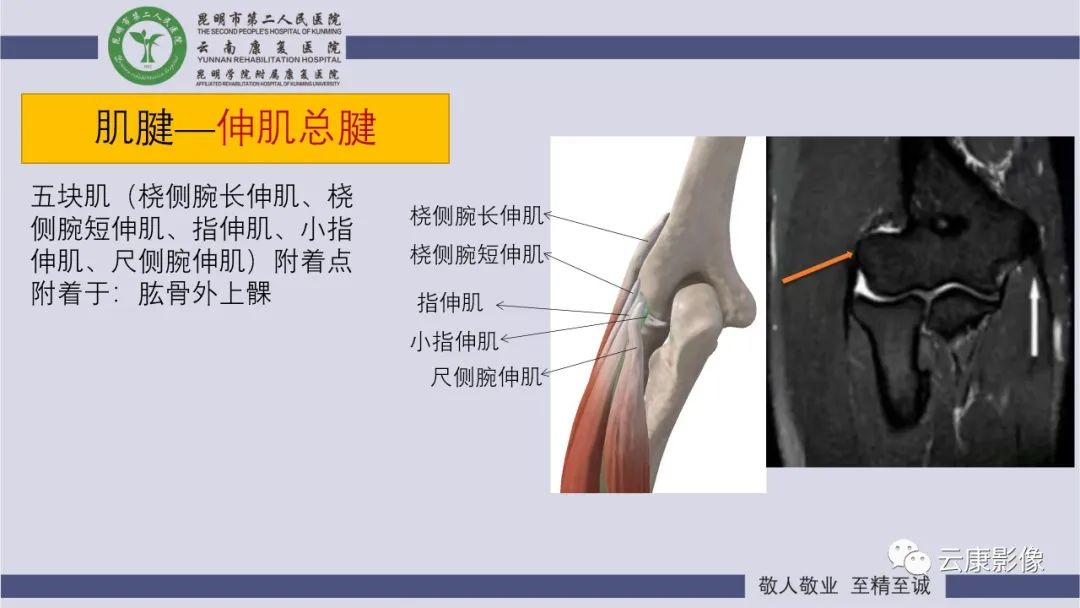 影像PPT - 【PPT】肘关节影像学解剖-29