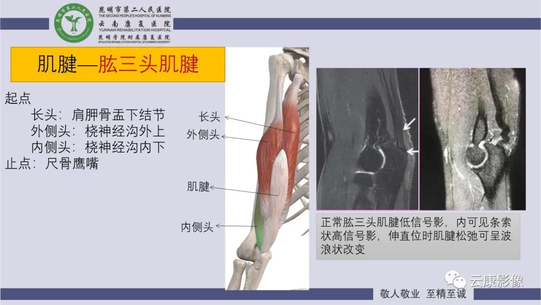 影像PPT - 【PPT】肘关节影像学解剖-30