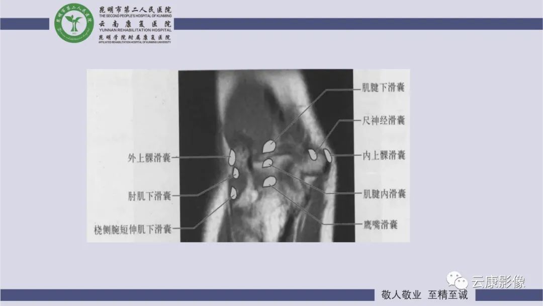 影像PPT - 【PPT】肘关节影像学解剖-33