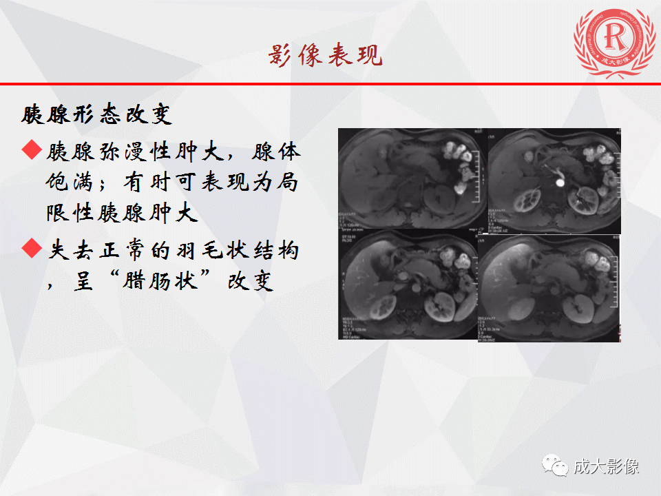 影像PPT - 【PPT】自身免疫性胰腺炎影像诊断-13