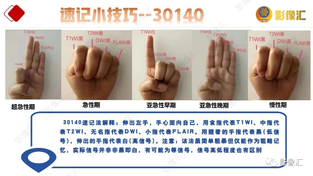 影像PPT - 【PPT】脑出血信号演变-41