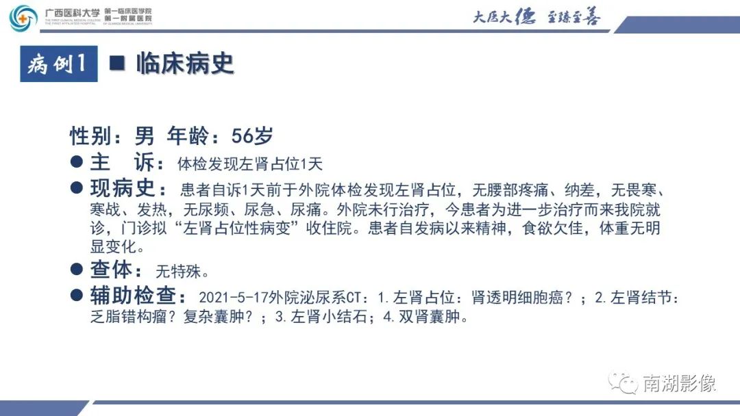 影像PPT - 【PPT】肾上皮样血管平滑肌脂肪瘤-2