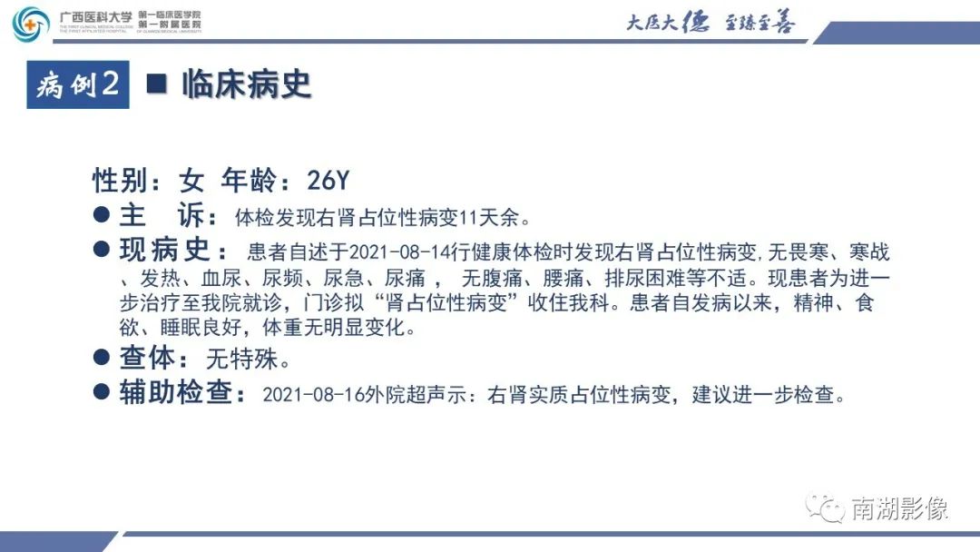 影像PPT - 【PPT】肾上皮样血管平滑肌脂肪瘤-6