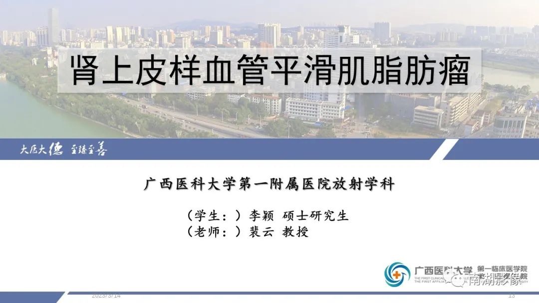 影像PPT - 【PPT】肾上皮样血管平滑肌脂肪瘤-12