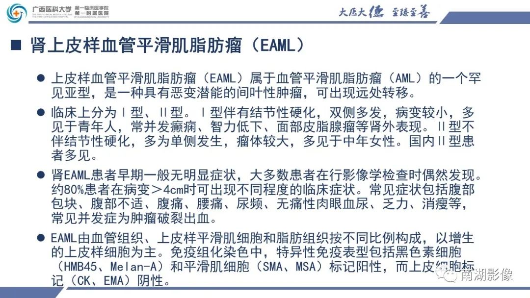 影像PPT - 【PPT】肾上皮样血管平滑肌脂肪瘤-14