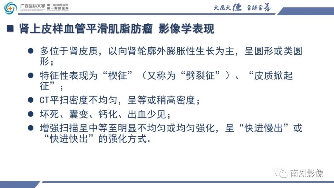 影像PPT - 【PPT】肾上皮样血管平滑肌脂肪瘤-15