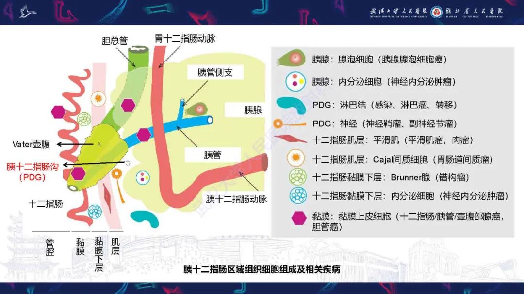 影像PPT - 【PPT】胰十二指肠沟病变影像诊断-4