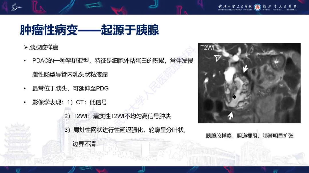 影像PPT - 【PPT】胰十二指肠沟病变影像诊断-22