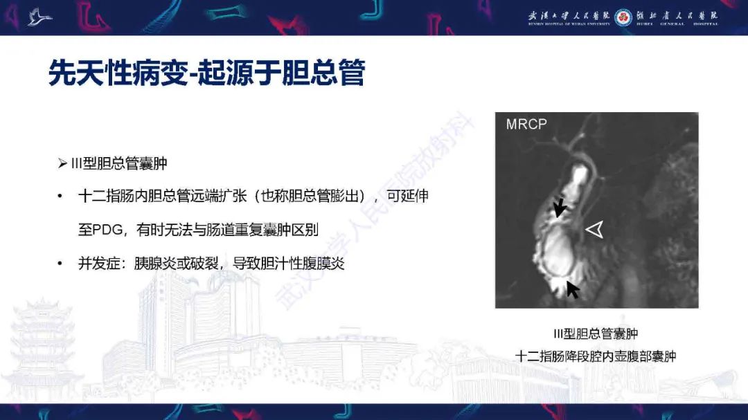 影像PPT - 【PPT】胰十二指肠沟病变影像诊断-30