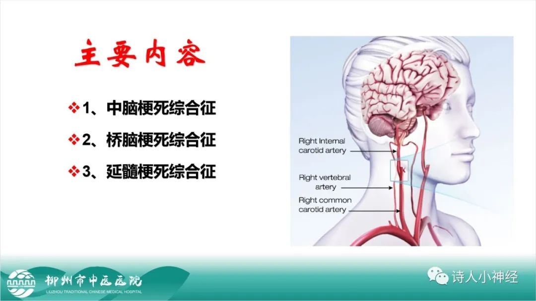影像PPT - 【PPT】各种脑干梗死综合征临床解剖及影像-2