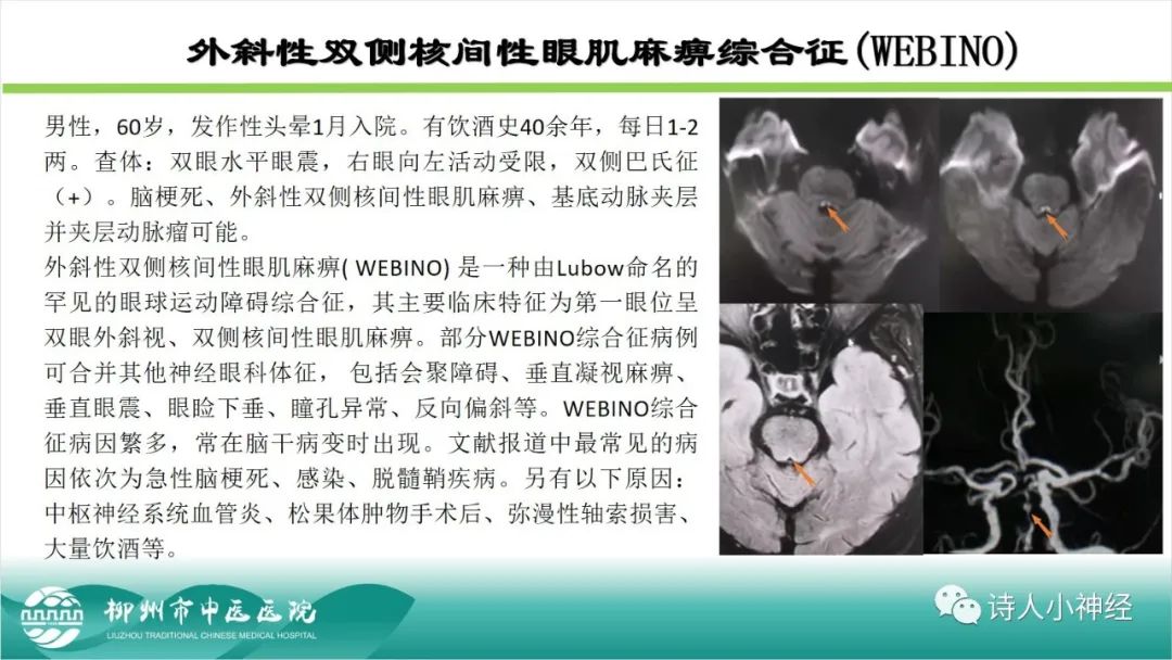 影像PPT - 【PPT】各种脑干梗死综合征临床解剖及影像-35
