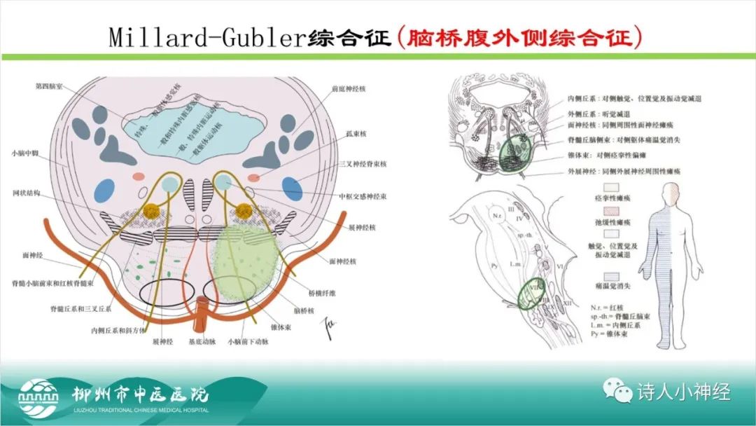 影像PPT - 【PPT】各种脑干梗死综合征临床解剖及影像-49