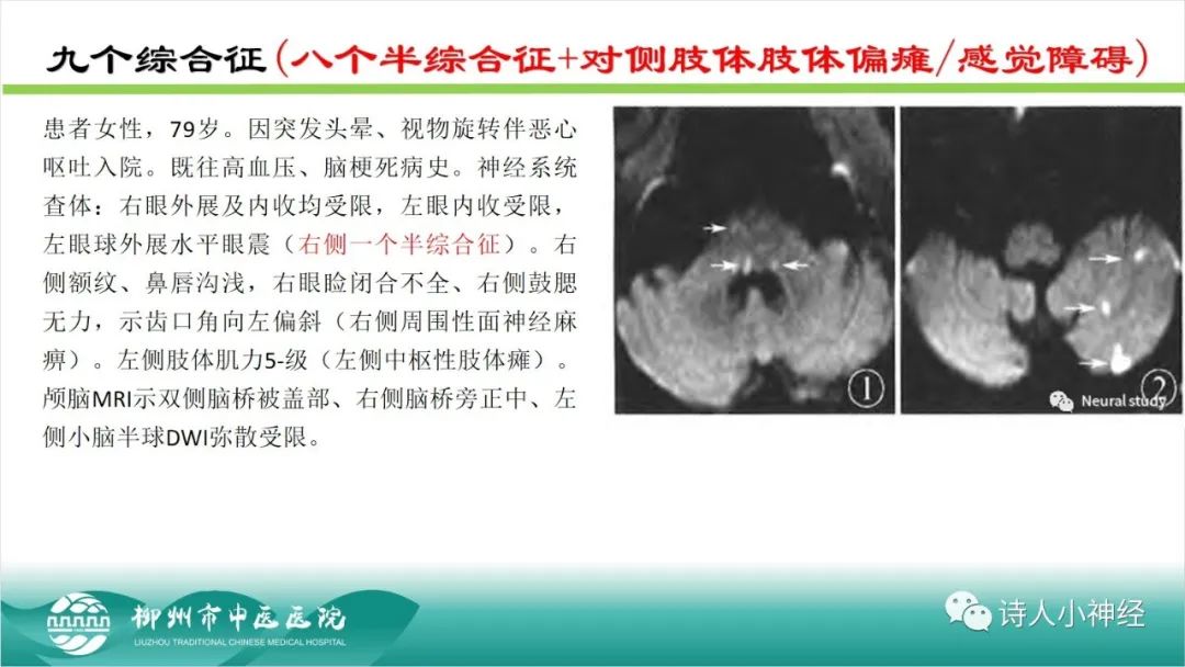影像PPT - 【PPT】各种脑干梗死综合征临床解剖及影像-57