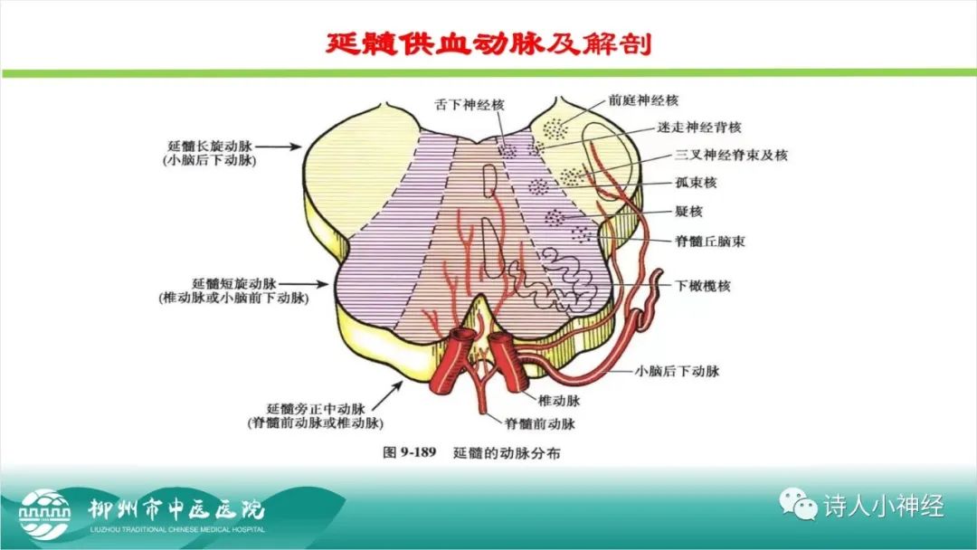 影像PPT - 【PPT】各种脑干梗死综合征临床解剖及影像-76