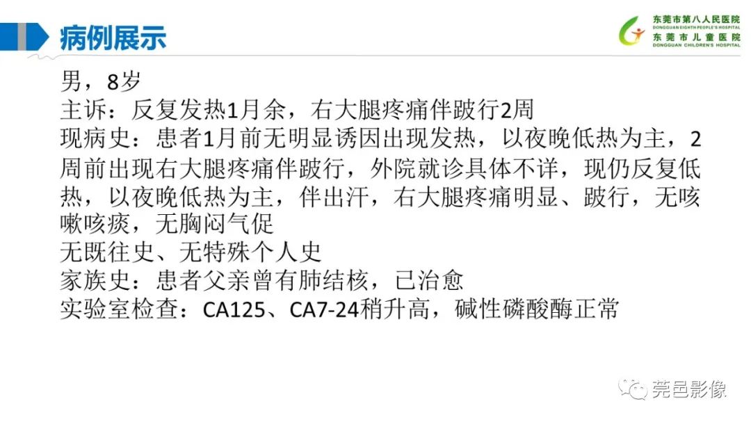 影像PPT - 【PPT】儿童骨淋巴瘤的影像表现-3