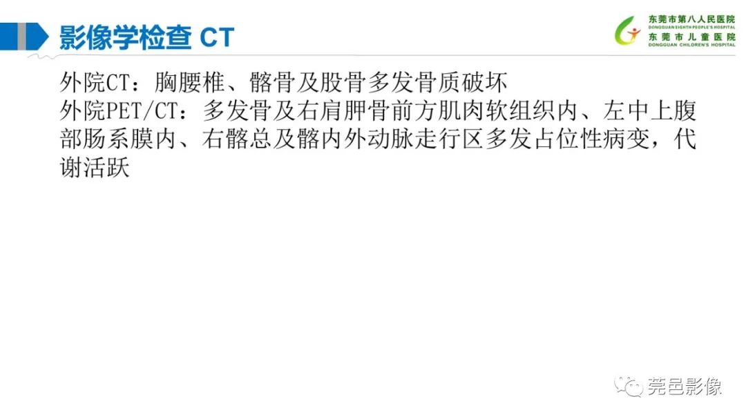 影像PPT - 【PPT】儿童骨淋巴瘤的影像表现-8