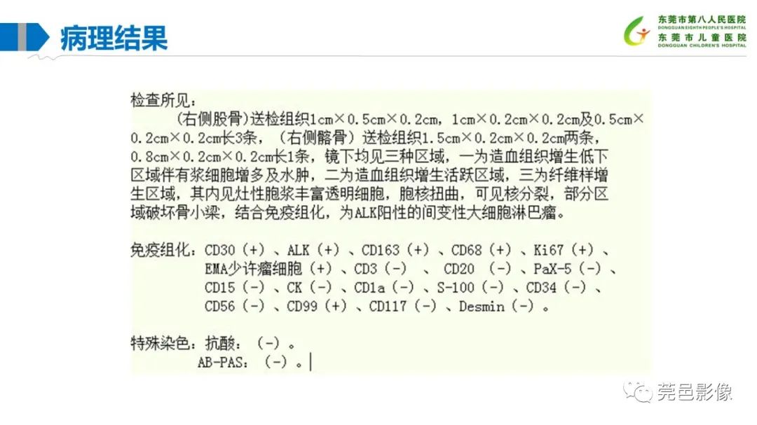 影像PPT - 【PPT】儿童骨淋巴瘤的影像表现-10