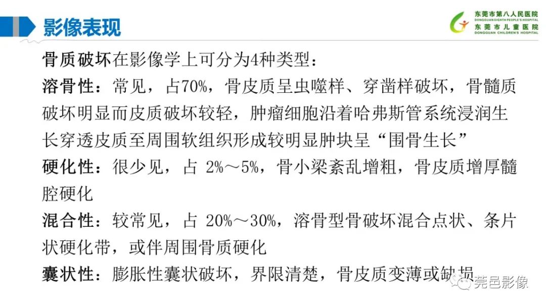 影像PPT - 【PPT】儿童骨淋巴瘤的影像表现-15