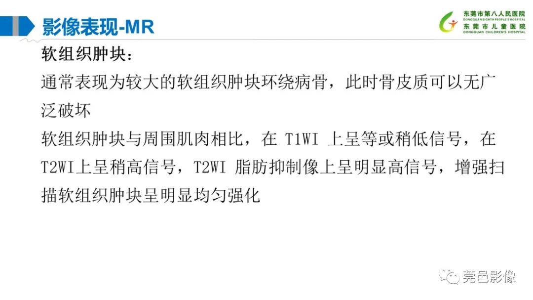影像PPT - 【PPT】儿童骨淋巴瘤的影像表现-26