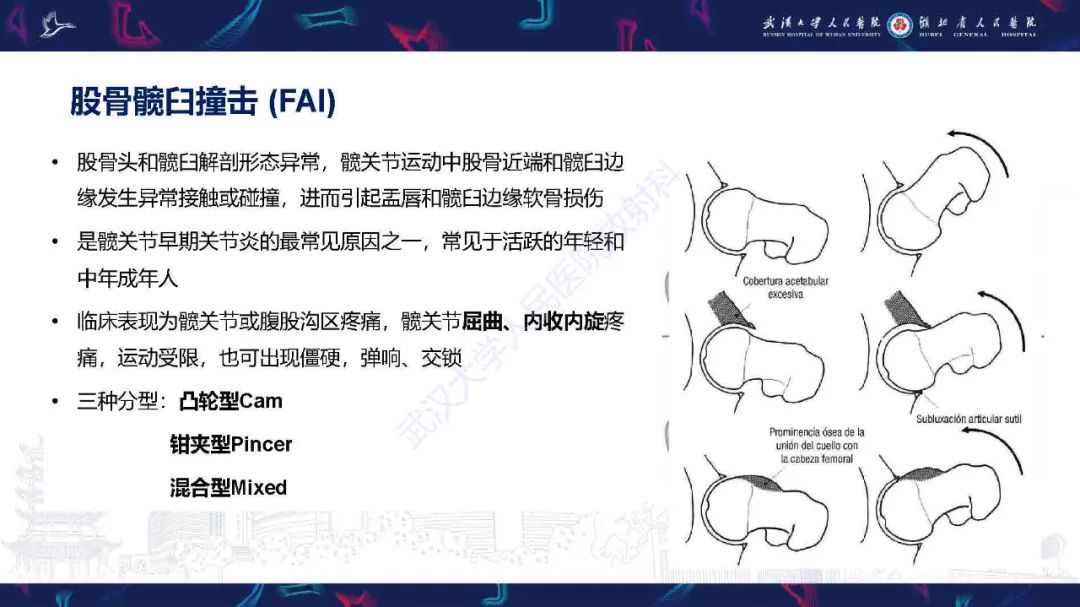 影像PPT - 【PPT】成人髋部疼痛MRI诊断-6