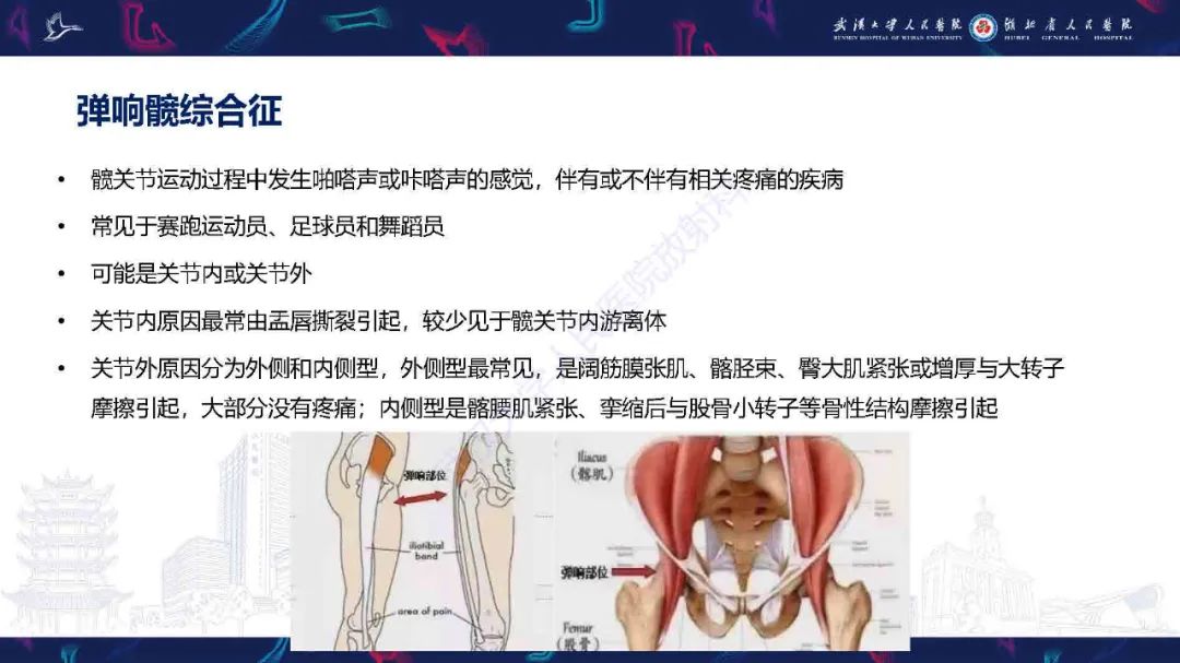 影像PPT - 【PPT】成人髋部疼痛MRI诊断-31
