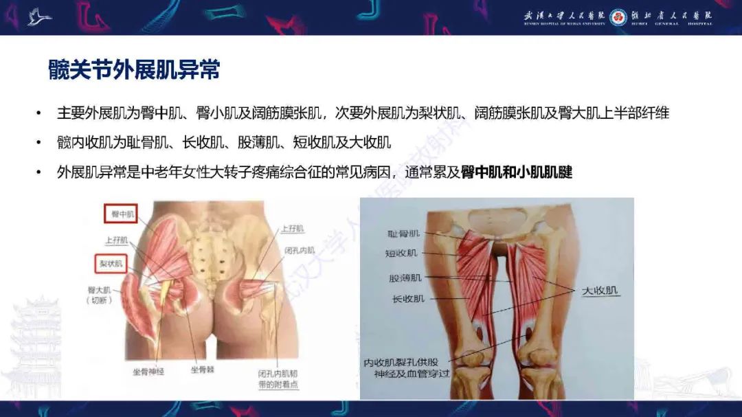 影像PPT - 【PPT】成人髋部疼痛MRI诊断-32