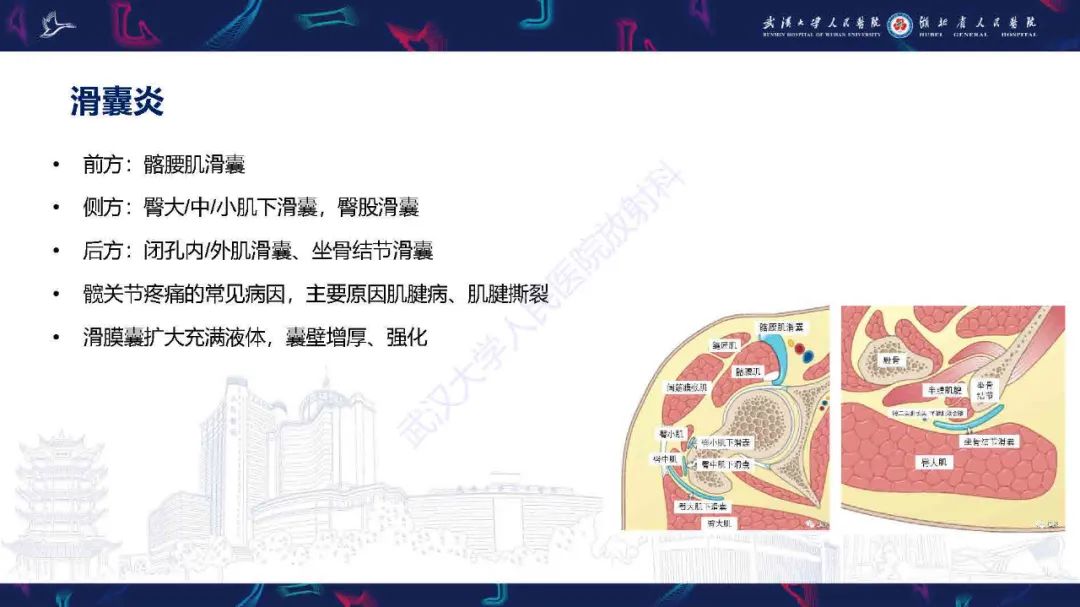 影像PPT - 【PPT】成人髋部疼痛MRI诊断-35