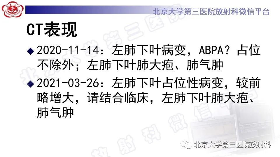 影像PPT - 【PPT】肺支气管闭锁-5