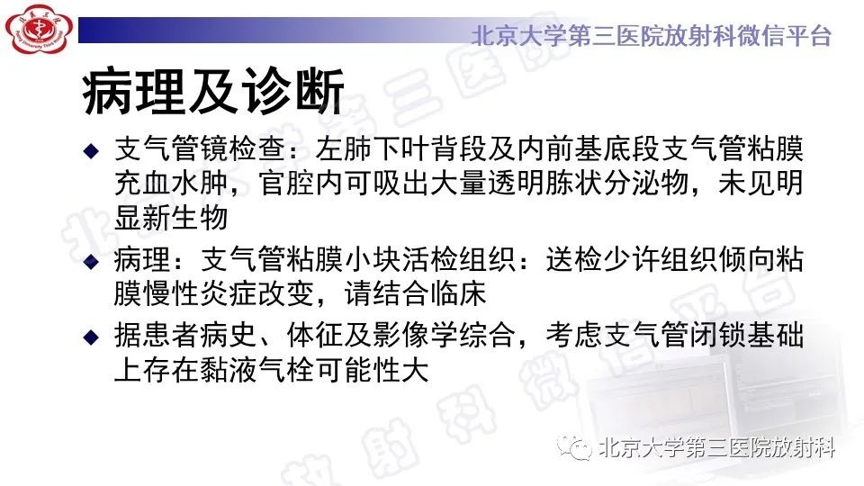 影像PPT - 【PPT】肺支气管闭锁-6