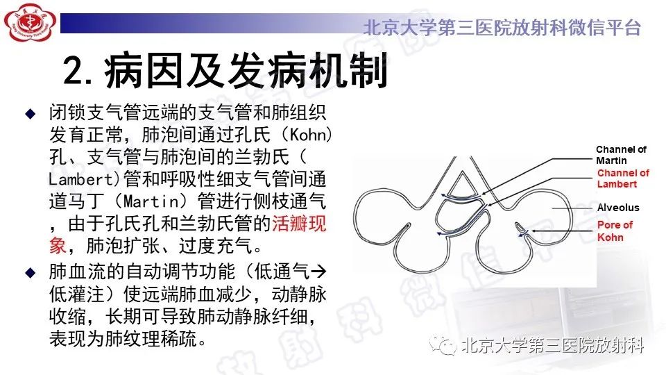 影像PPT - 【PPT】肺支气管闭锁-11