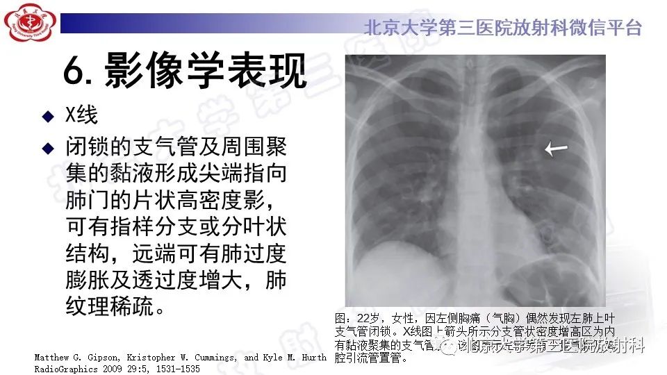 影像PPT - 【PPT】肺支气管闭锁-15
