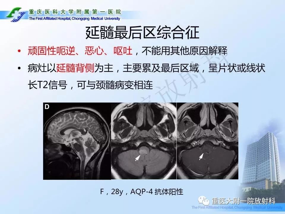 影像PPT - 【PPT】视神经脊髓炎临床及MRI特征-17