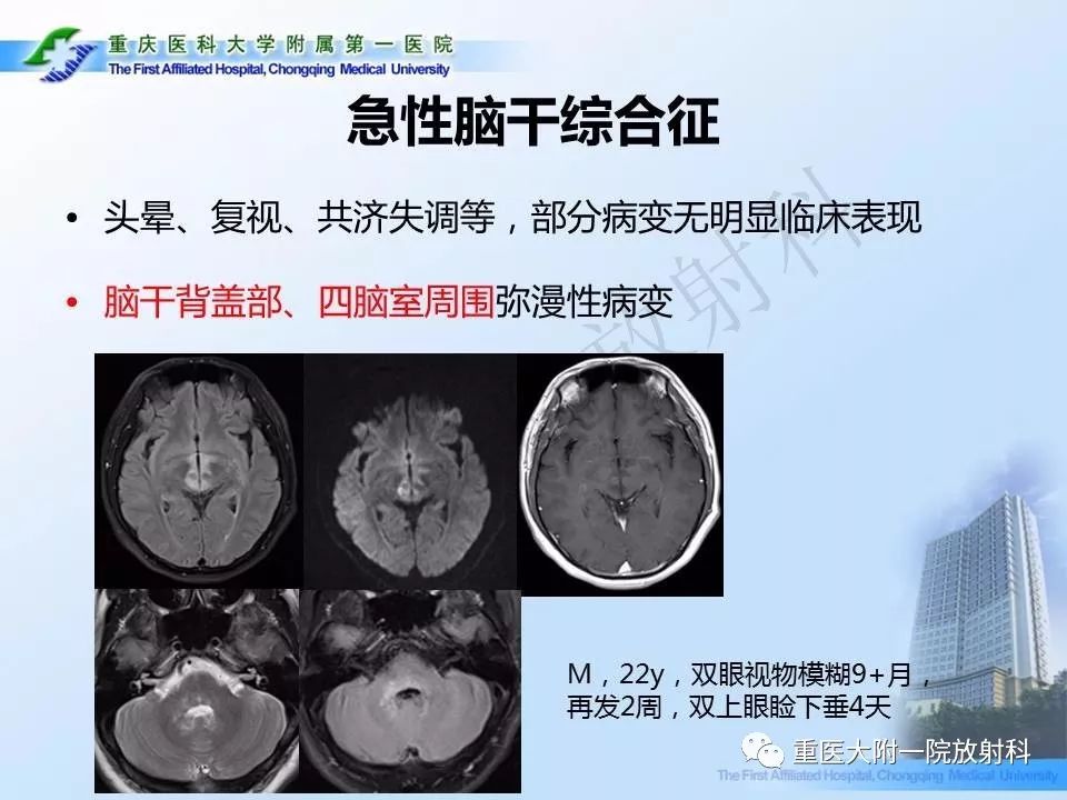 影像PPT - 【PPT】视神经脊髓炎临床及MRI特征-19
