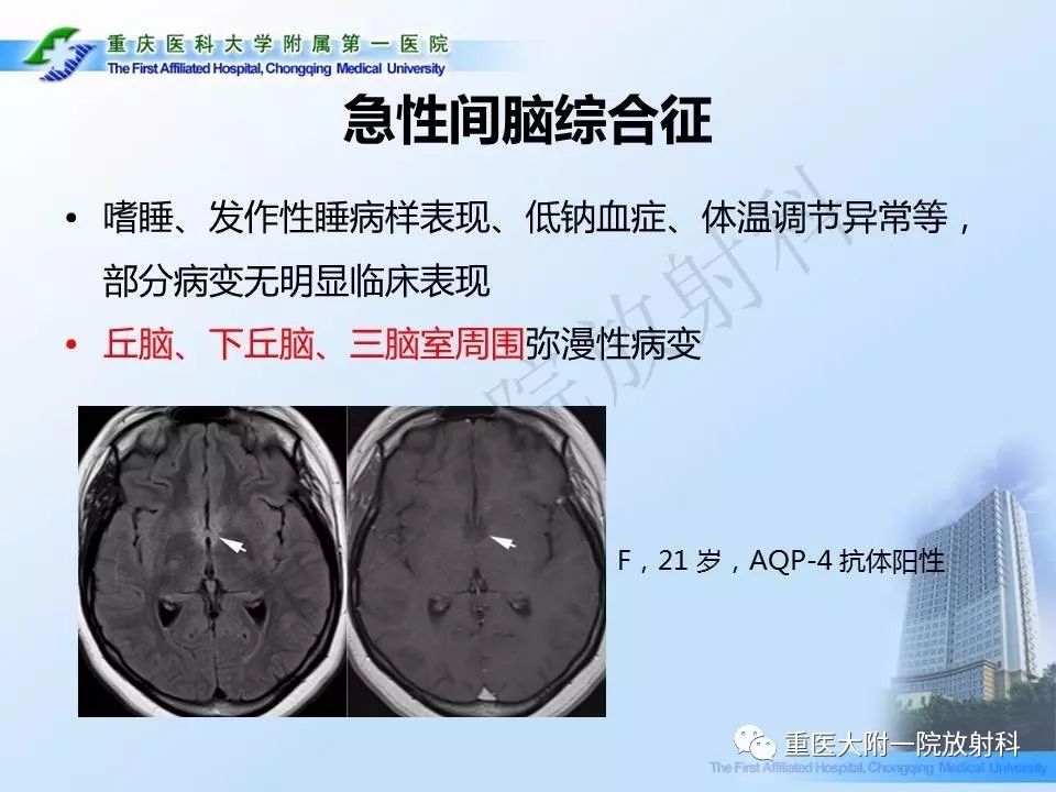 影像PPT - 【PPT】视神经脊髓炎临床及MRI特征-20