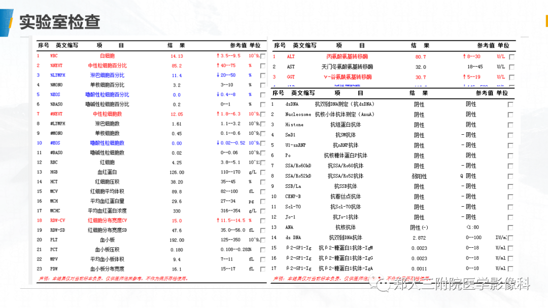 影像PPT - 【PPT】MOG抗体相关疾病-3