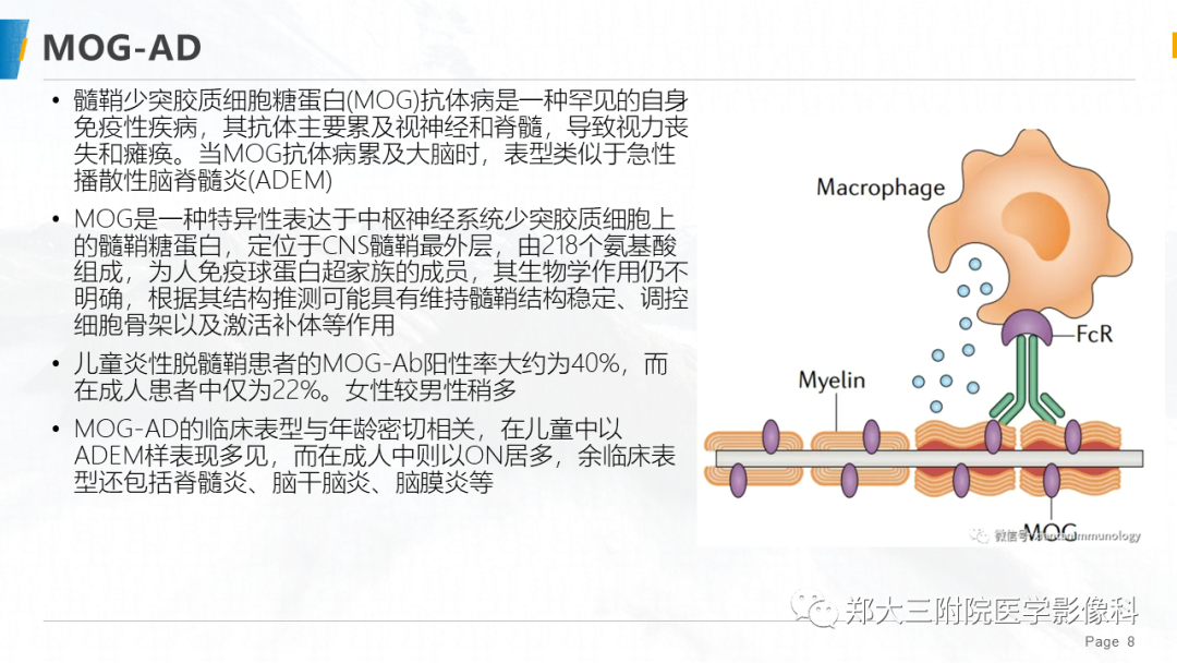 影像PPT - 【PPT】MOG抗体相关疾病-8