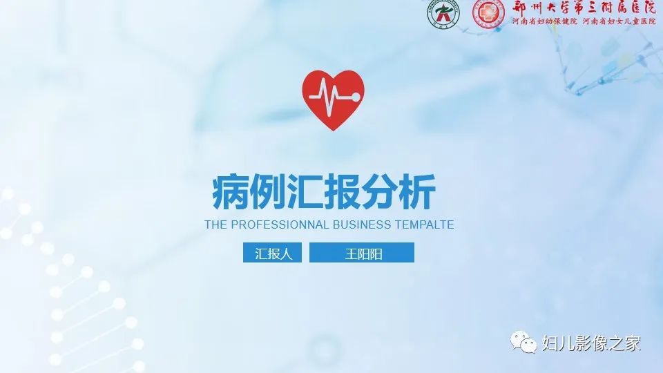 影像PPT - 【病例】幕上毛细胞型星形细胞瘤1例MR-1