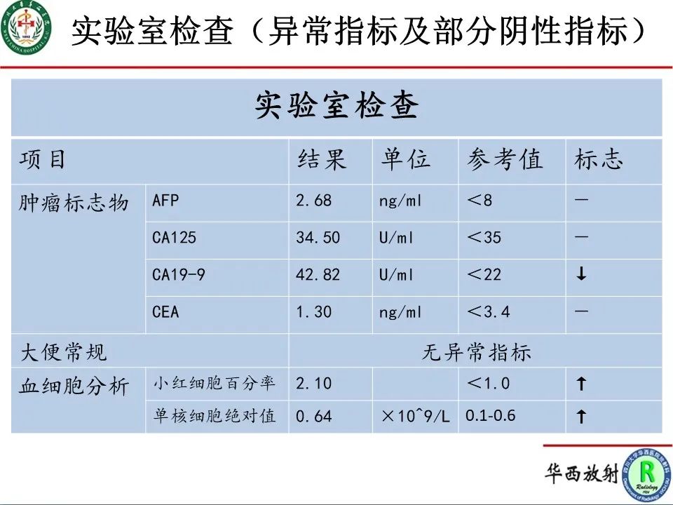 影像PPT - 【病例】直肠子宫内膜异位症1例MR影像-2