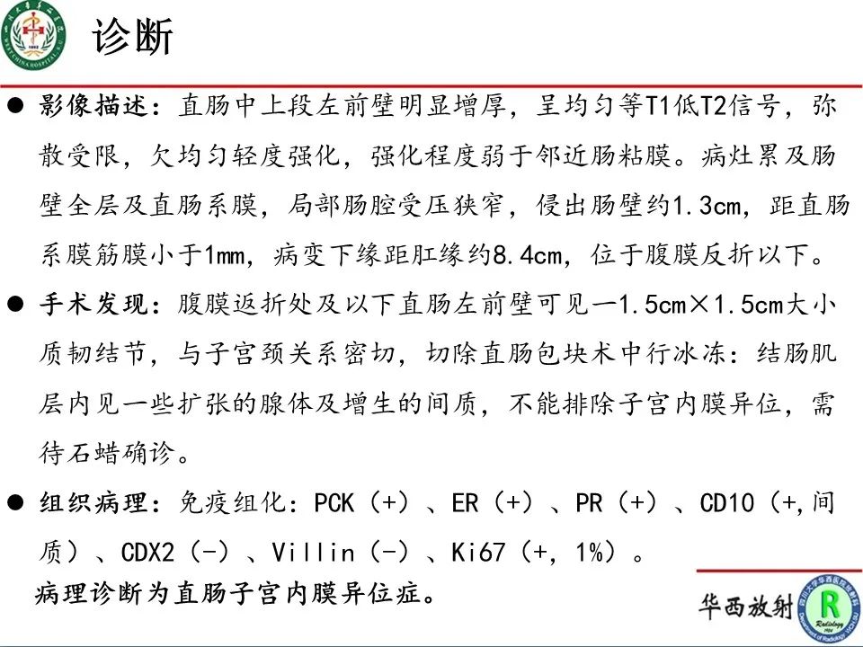 影像PPT - 【病例】直肠子宫内膜异位症1例MR影像-11