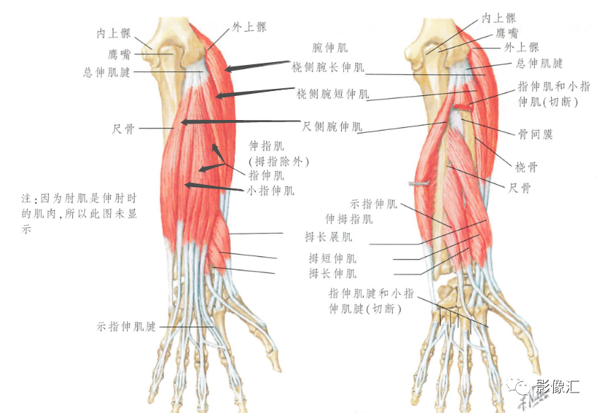 影像PPT - 【病例】肱骨外上髁炎1例MR影像详解-16 影像PPT - 【病例】肱骨外上髁炎1例MR影像详解-16