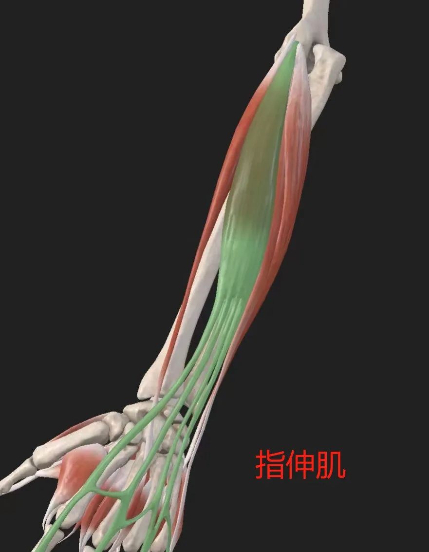 影像PPT - 【病例】肱骨外上髁炎1例MR影像详解-18 影像PPT - 【病例】肱骨外上髁炎1例MR影像详解-18