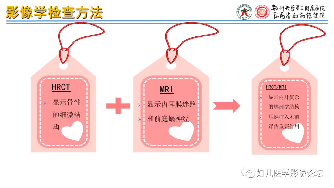 影像PPT - 【PPT】感音神经性耳聋影像诊断-6