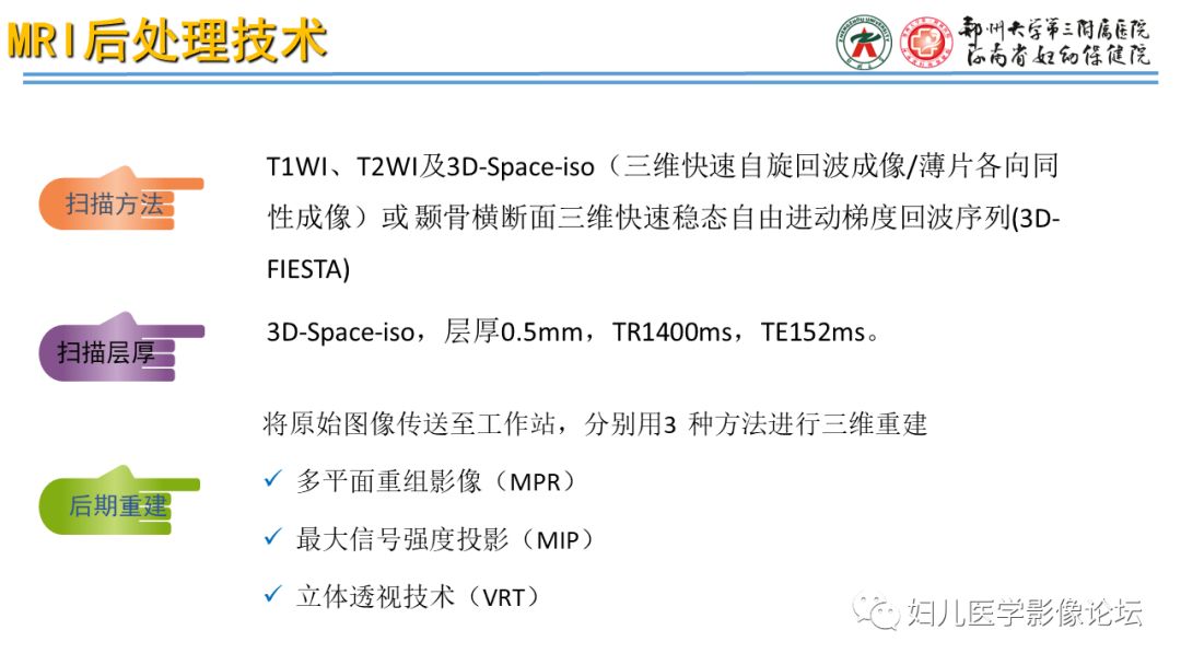 影像PPT - 【PPT】感音神经性耳聋影像诊断-21