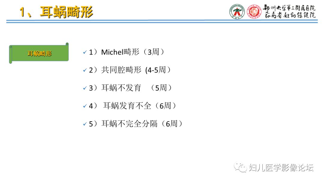 影像PPT - 【PPT】感音神经性耳聋影像诊断-37